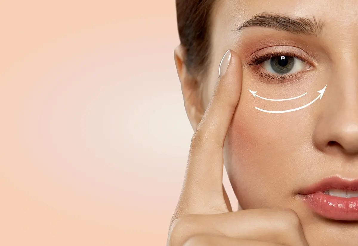 A woman contemplating eye bag surgery