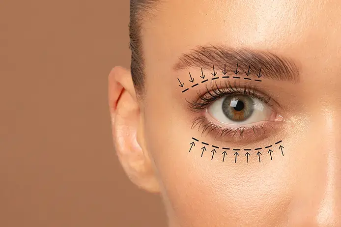 Female patient planning a visit to the eyelid enhancement clinic for an eyelid 