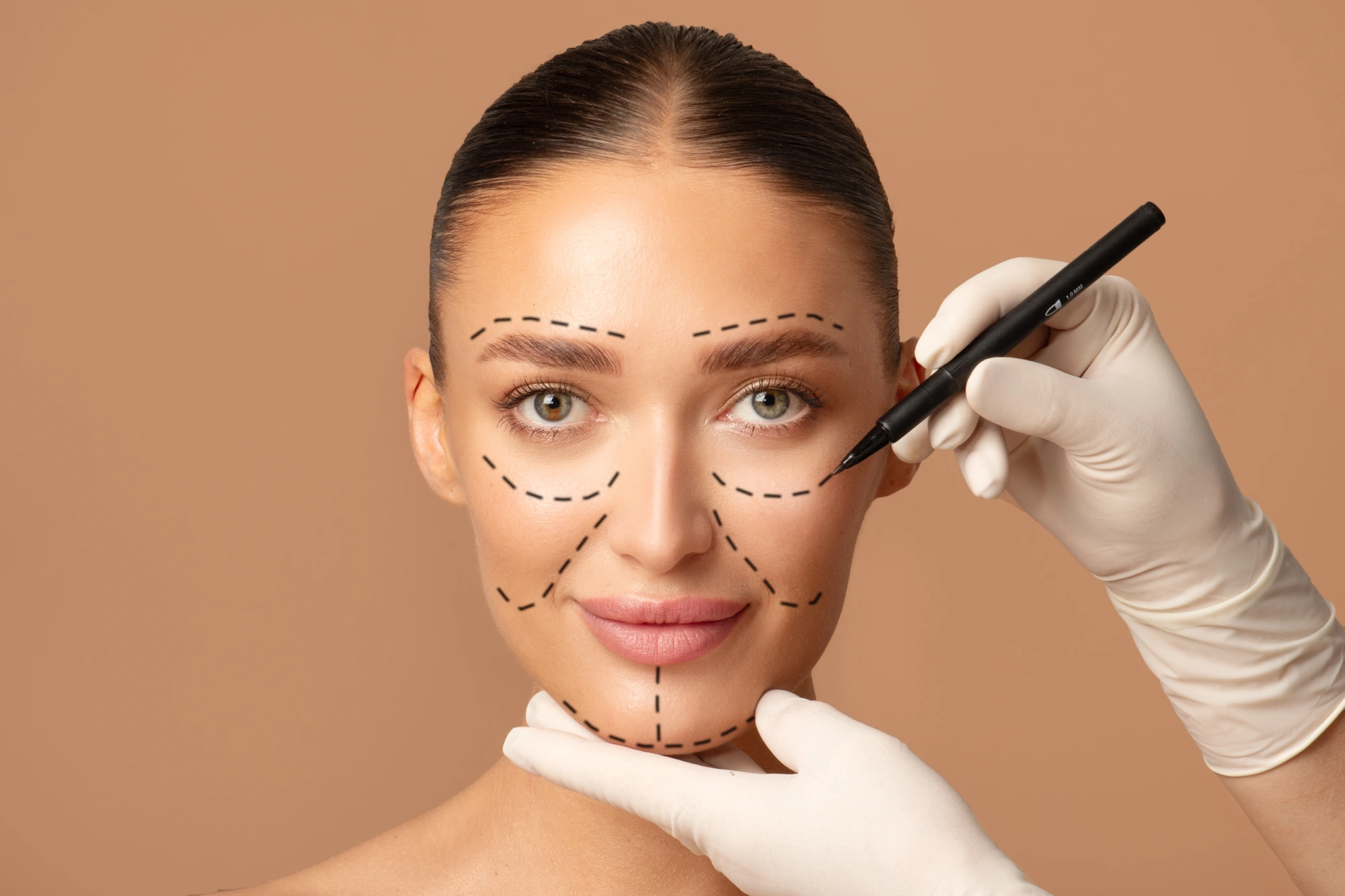 Ptosis vs. Dermatochalasis: How to Tell the Difference