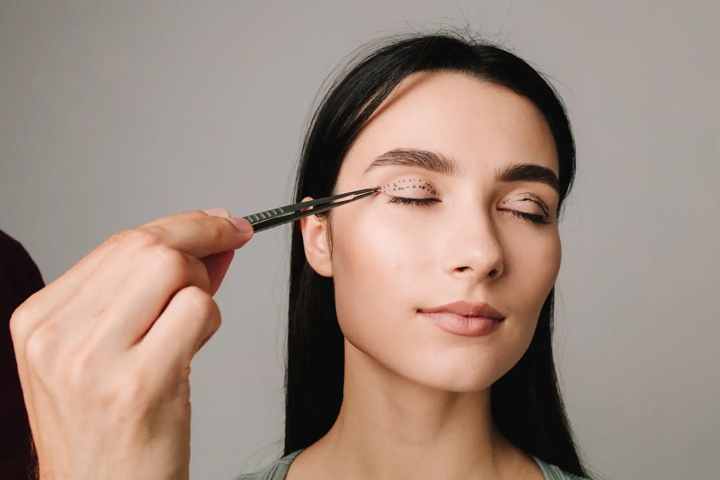Incisional vs. Non-Incisional Eyelid Surgery Recovery: What to Expect
